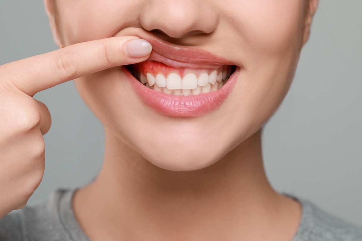 How to Prevent Gum Disease: Tips for Healthy Gums and Teeth