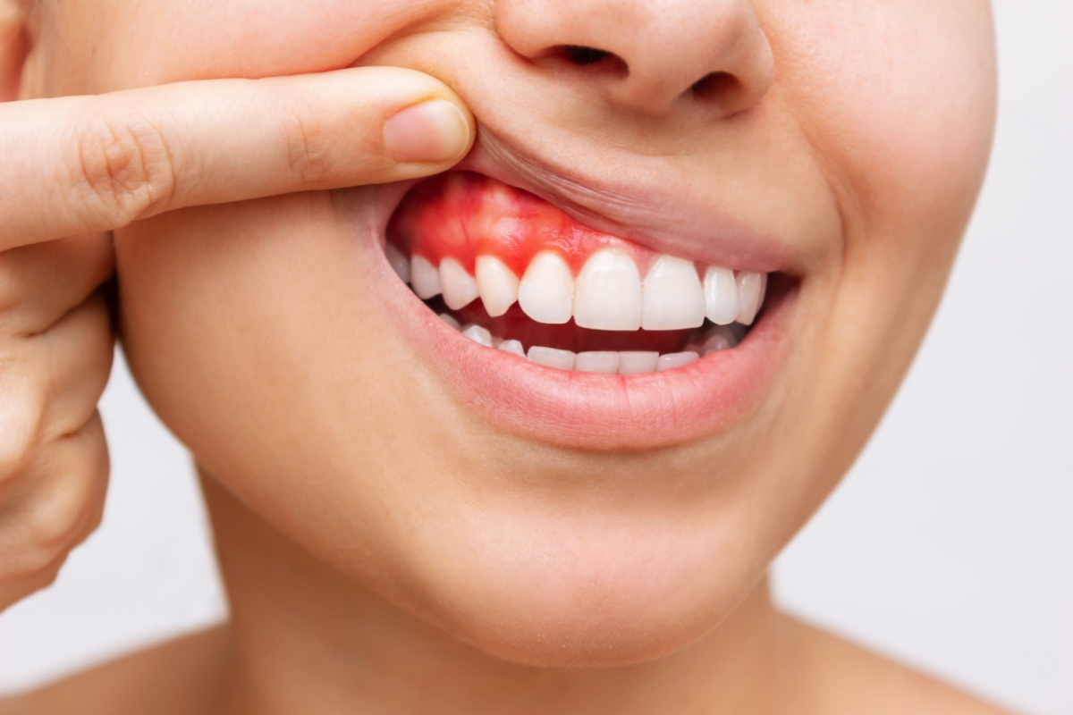 How Periodontal Disease Affects Your Overall Health